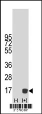 Western blot analysis of his-tag TUSC2 (arrow) using his tag antibody. 293T cell lysates (2 ug/lane) either nontransfected (Lane 1) or transiently transfected with the TUSC2 gene‘