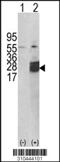 Western blot analysis of his-tag IFNW1 (arrow) using his tag antibody. 293 cell lysates (2 ug/lane) either nontransfected (Lane 1) or transiently transfected with the IFNW1 gene (Lane 2, Cat. #LY10444a).