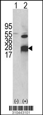 Western blot analysis of his-tag IFNA21 (arrow) using his tag antibody. 293 cell lysates (2 ug/lane) either nontransfected (Lane 1) or transiently transfected with the IFNA21 gene (Lane 2, Cat. #LY10443a).