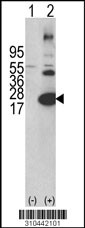 Western blot analysis of his-tag IFNA10 (arrow) using his tag antibody. 293 cell lysates (2 ug/lane) either nontransfected (Lane 1) or transiently transfected with the IFNA10 gene (Lane 2, Cat. #LY10442a).