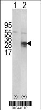 Western blot analysis of his-tag IL33 (arrow) using his tag antibody. 293 cell lysates (2 ug/lane) either nontransfected (Lane 1) or transiently transfected with the IL33 gene (Lane 2, Cat. #LY10440a).