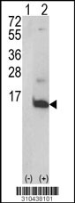 Western blot analysis of his-tag PF4V1 (arrow) using his tag antibody. 293 cell lysates (2 ug/lane) either nontransfected (Lane 1) or transiently transfected with the PF4V1 gene (Lane 2, Cat. #LY10438a).