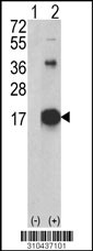 Western blot analysis of his-tag IL21 (arrow) using his tag antibody. 293 cell lysates (2 ug/lane) either nontransfected (Lane 1) or transiently transfected with the IL21 gene (Lane 2, Cat. #LY10437a).