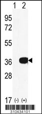 Western blot analysis of his-tag DCK (arrow) using his tag antibody. 293 cell lysates (2 ug/lane) either nontransfected (Lane 1) or transiently transfected with the DCK gene