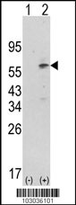 Western blot analysis of PDK1 (arrow) using rabbit polyclonal hPDK1-G14 (RB03036). 293 cell lysates (2 ug/lane) either nontransfected (Lane 1) or transiently transfected with the PDK1 gene (Lane 2) (Origene Technologies).