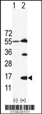 Western blot analysis of his-tag CCL4 (arrow) using his tag antibody. 293 cell lysates (2 ug/lane) either nontransfected (Lane 1) or transiently transfected with the CCL4 gene