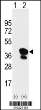 Western blot analysis of his-tag RP2 (arrow) using his tag antibody. 293 cell lysates (2 ug/lane) either nontransfected (Lane 1) or transiently transfected with the RP2 gene