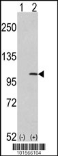 Western blot analysis of FGFR1 (arrow) using rabbit polyclonal hFGFR1-C806 (RB01566). 293 cell lysates (2 ug/lane) either nontransfected (Lane 1) or transiently transfected with the FGFR1 gene (Lane 2) (Origene Technologies).