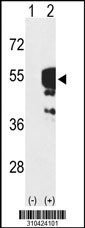 Western blot analysis of his-tag PFKFB4 (arrow) using his tag antibody. 293 cell lysates (2 ug/lane) either nontransfected (Lane 1) or transiently transfected with the PFKFB4 gene