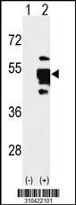 Western blot analysis of his-tag PDK4 (arrow) using his tag antibody. 293 cell lysates (2 ug/lane) either nontransfected (Lane 1) or transiently transfected with the PDK4 gene