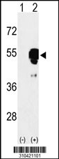 Western blot analysis of his-tag ILK (arrow) using his tag antibody. 293 cell lysates (2 ug/lane) either nontransfected (Lane 1) or transiently transfected with the ILK gene