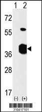 Western blot analysis of his-tag CDK5R1 (arrow) using his tag antibody. 293 cell lysates (2 ug/lane) either nontransfected (Lane 1) or transiently transfected with the CDK5R1 gene