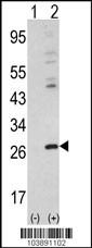 Western blot analysis of AKL3L (arrow) using rabbit polyclonal hAKL3L-Q213 (RB03891). 293 cell lysates (2 ug/lane) either nontransfected (Lane 1) or transiently transfected with the AKL3L gene (Lane 2).