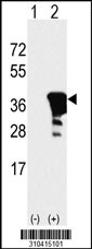 Western blot analysis of his-tag DNASE1 (arrow) using his tag antibody. 293 cell lysates (2 ug/lane) either nontransfected (Lane 1) or transiently transfected with the DNASE1 gene