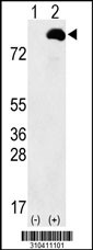 Western blot analysis of his-tag PI4KB (arrow) using his tag antibody. 293 cell lysates (2 ug/lane) either nontransfected (Lane 1) or transiently transfected with the