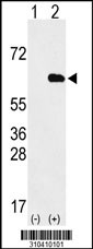 Western blot analysis of his-tag RNGTT (arrow) using his tag antibody. 293 cell lysates (2 ug/lane) either nontransfected (Lane 1) or transiently transfected with the RNGTT gene