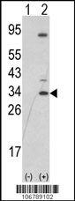 Western blot analysis of SNAIL (arrow) using rabbit polyclonal SNAIL N-term Antibody (RB06789). 293 cell lysates (2 ug/lane) either nontransfected (Lane 1) or transiently transfected with the SNAIL gene (Lane 2) (Origene Technologies).