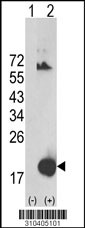 Western blot analysis of his-tag C19orf10 (arrow) using his tag antibody. 293 cell lysates (2 ug/lane) either nontransfected (Lane 1) or transiently transfected with the C19orf10 gene (Lane 2, Cat. #LY10405a).