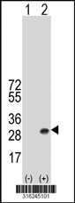 Western blot analysis of his-tag REEP1 (arrow) using his tag antibody. 293T cell lysates (2 ug/lane) either nontransfected (Lane 1) or transiently transfected with the REEP1 gene‘