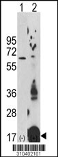 Western blot analysis of his-tag IGF1 (arrow) using his tag antibody. 293 cell lysates (2 ug/lane) either nontransfected (Lane 1) or transiently transfected with the IGF1 gene (Lane 2, Cat. #LY10402a).