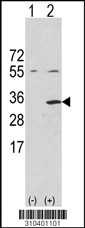 Western blot analysis of his-tag NRG1 (arrow) using his tag antibody. 293 cell lysates (2 ug/lane) either nontransfected (Lane 1) or transiently transfected with the NRG1 gene (Lane 2, Cat. #LY10401a).