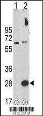 Western blot analysis of his-tag GMFB (arrow) using his tag antibody. 293 cell lysates (2 ug/lane) either nontransfected (Lane 1) or transiently transfected with the GMFB gene (Lane 2, Cat. #LY10400a).