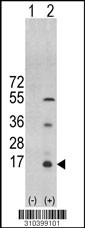 Western blot analysis of his-tag FGF7 (arrow) using his tag antibody. 293 cell lysates (2 ug/lane) either nontransfected (Lane 1) or transiently transfected with the FGF7 gene (Lane 2, Cat. #LY10399a).