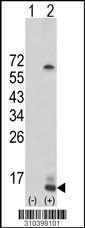 Western blot analysis of his-tag FGF5 (arrow) using his tag antibody. 293 cell lysates (2 ug/lane) either nontransfected (Lane 1) or transiently transfected with the FGF5 gene (Lane 2, Cat. #LY10398a).
