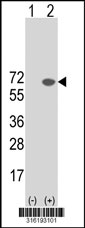 Western blot analysis of his-tag APLF (arrow) using his tag antibody. 293T cell lysates (2 ug/lane) either nontransfected (Lane 1) or transiently transfected with the APLF gene‘