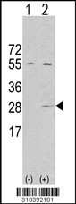 Western blot analysis of his-tag GSTM4 (arrow) using his tag antibody. 293 cell lysates (2 ug/lane) either nontransfected (Lane 1) or transiently transfected with the GSTM4 gene (Lane 2, Cat. #LY10392a).