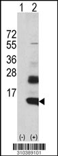 Western blot analysis of his-tag FCER1G (arrow) using his tag antibody. 293 cell lysates (2 ug/lane) either nontransfected (Lane 1) or transiently transfected with the FCER1G gene (Lane 2, Cat. #LY10389a).