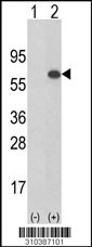 Western blot analysis of his-tag SGMS2 (arrow) using his tag antibody. 293 cell lysates (2 ug/lane) either nontransfected (Lane 1) or transiently transfected with the SGMS2 gene (Lane 2, Cat. #LY10387a).
