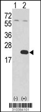Western blot analysis of his-tag IL1F10 (arrow) using his tag antibody. 293 cell lysates (2 ug/lane) either nontransfected (Lane 1) or transiently transfected with the IL1F10 gene (Lane 2, Cat. #LY10384a).
