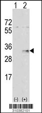 Western blot analysis of his-tag FGF17 (arrow) using his tag antibody. 293 cell lysates (2 ug/lane) either nontransfected (Lane 1) or transiently transfected with the FGF17 gene (Lane 2, Cat. #LY10382a).