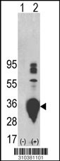 Western blot analysis of his-tag GDF15 (arrow) using his tag antibody. 293 cell lysates (2 ug/lane) either nontransfected (Lane 1) or transiently transfected with the GDF15 gene (Lane 2, Cat. #LY10381a).