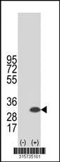 Western blot analysis of his-tag EMG1 (arrow) using his tag antibody. 293T cell lysates (2 ug/lane) either nontransfected (Lane 1) or transiently transfected with the EMG1 gene‘