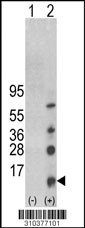 Western blot analysis of his-tag ARMETL1 (arrow) using his tag antibody. 293 cell lysates (2 ug/lane) either nontransfected (Lane 1) or transiently transfected with the ARMETL1 gene (Lane 2, Cat. #LY10377a).