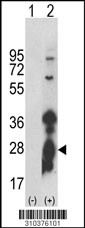 Western blot analysis of his-tag IL3 (arrow) using his tag antibody. 293 cell lysates (2 ug/lane) either nontransfected (Lane 1) or transiently transfected with the IL3 gene (Lane 2, Cat. #LY10376a).