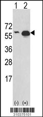 Western blot analysis of his-tag GDF2 (arrow) using his tag antibody. 293 cell lysates (2 ug/lane) either nontransfected (Lane 1) or transiently transfected with the GDF2 gene (Lane 2, Cat. #LY10375a).