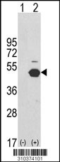 Western blot analysis of his-tag PDGFD (arrow) using his tag antibody. 293 cell lysates (2 ug/lane) either nontransfected (Lane 1) or transiently transfected with the PDGFD gene (Lane 2, Cat. #LY10374a).