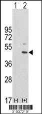Western blot analysis of his-tag ALS2CR2 (arrow) using his tag antibody. 293 cell lysates (2 ug/lane) either nontransfected (Lane 1) or transiently transfected with the ALS2CR2 gene (Lane 2, Cat. #LY10372a).