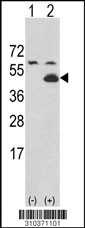 Western blot analysis of his-tag PDGFRL (arrow) using his tag antibody. 293 cell lysates (2 ug/lane) either nontransfected (Lane 1) or transiently transfected with the PDGFRL gene (Lane 2, Cat. #LY10371a).