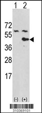 Western blot analysis of his-tag LRPAP1 (arrow) using his tag antibody. 293 cell lysates (2 ug/lane) either nontransfected (Lane 1) or transiently transfected with the LRPAP1 gene (Lane 2, Cat. #LY10369a).
