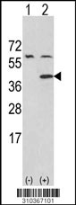 Western blot analysis of his-tag GNAI3 (arrow) using his tag antibody. 293 cell lysates (2 ug/lane) either nontransfected (Lane 1) or transiently transfected with the GNAI3 gene (Lane 2, Cat. #LY10367a).