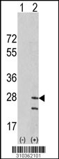Western blot analysis of his-tag FXN (arrow) using his tag antibody. 293 cell lysates (2 ug/lane) either nontransfected (Lane 1) or transiently transfected with the FXN gene (Lane 2, Cat. #LY10362a).