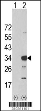 Western blot analysis of his-tag NDUFB8 (arrow) using his tag antibody. 293 cell lysates (2 ug/lane) either nontransfected (Lane 1) or transiently transfected with the NDUFB8 gene (Lane 2, Cat. #LY10361a).