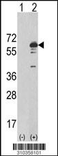 Western blot analysis of his-tag WNK1 (arrow) using his tag antibody. 293 cell lysates (2 ug/lane) either nontransfected (Lane 1) or transiently transfected with the WNK1 gene (Lane 2, Cat. #LY10358a).