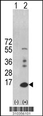 Western blot analysis of his-tag PANK1 (arrow) using his tag antibody. 293 cell lysates (2 ug/lane) either nontransfected (Lane 1) or transiently transfected with the PANK1 gene (Lane 2, Cat. #LY10356a).