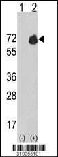 Western blot analysis of his-tag PRKD2 (arrow) using his tag antibody. 293 cell lysates (2 ug/lane) either nontransfected (Lane 1) or transiently transfected with the PRKD2 gene (Lane 2, Cat. #LY10355a).