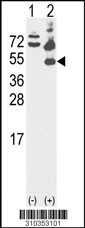 Western blot analysis of his-tag BCKDK (arrow) using his tag antibody. 293 cell lysates (2 ug/lane) either nontransfected (Lane 1) or transiently transfected with the BCKDK gene (Lane 2, Cat. #LY10353a).
